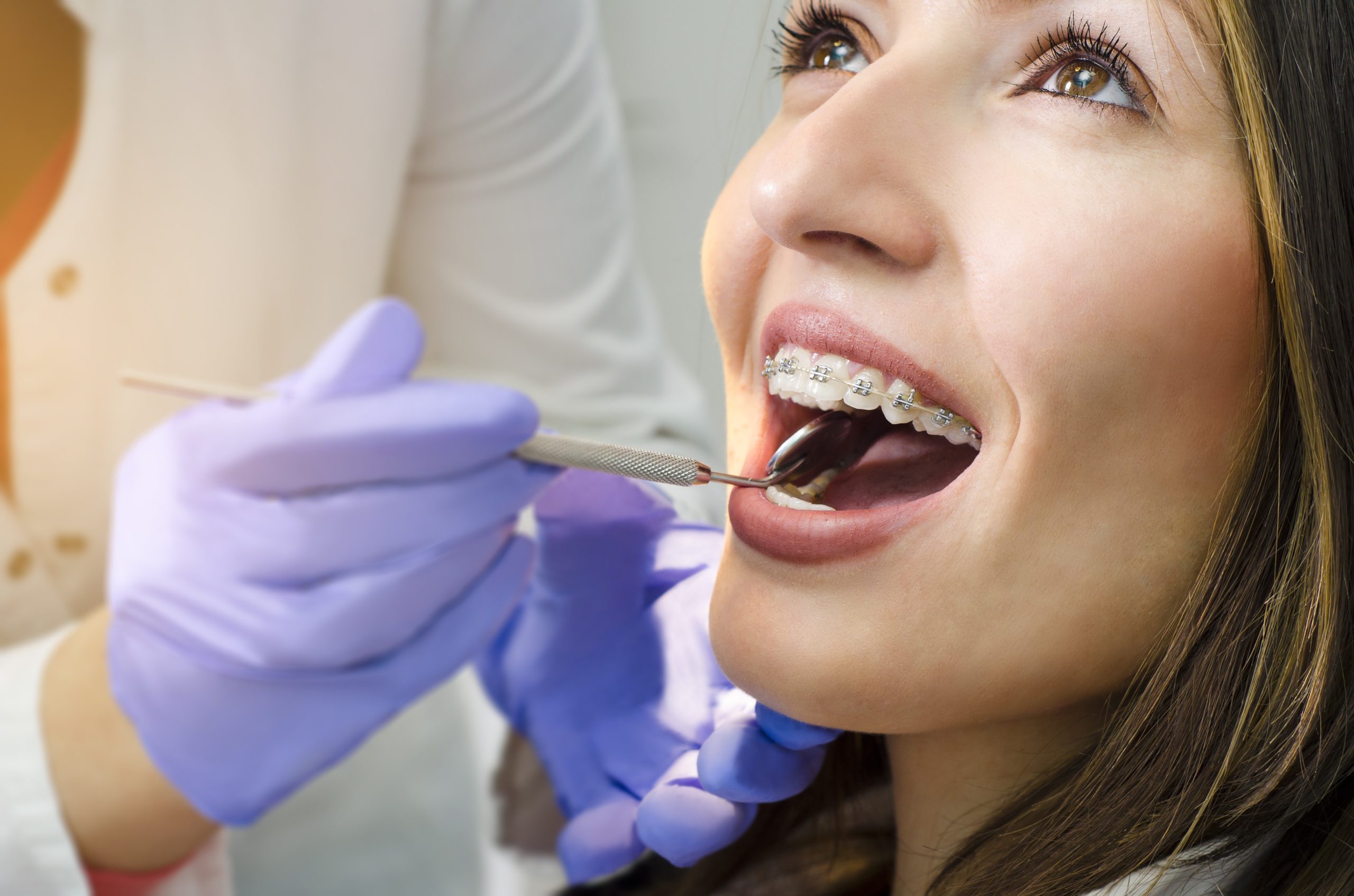 dillehay ortho wichita adult braces invisalign