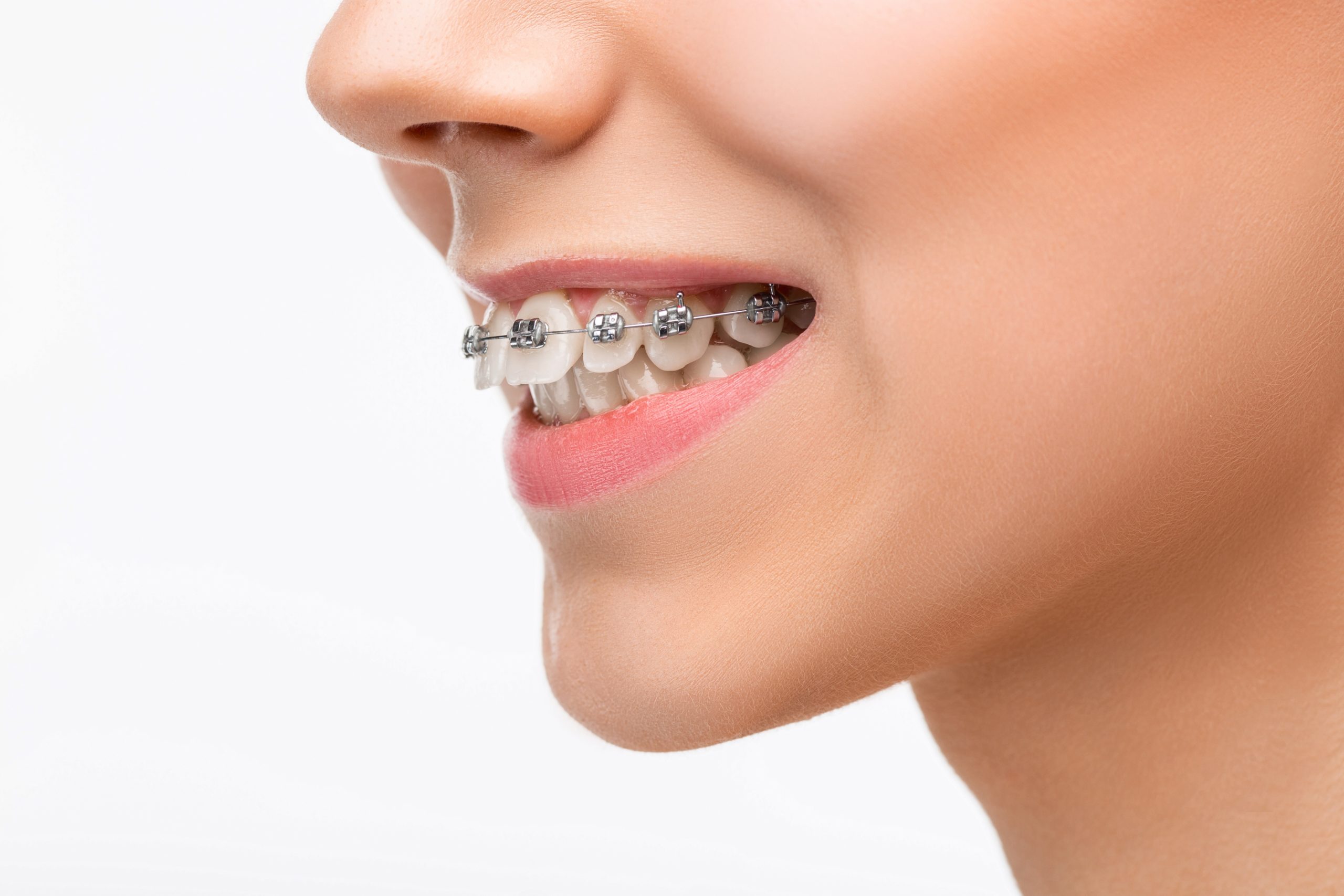 dillehay ortho wichita braces invisalign derby adult ortho