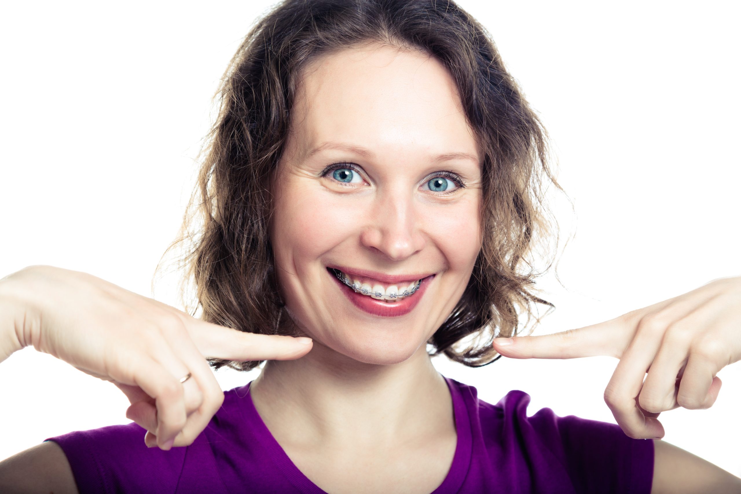 How do Braces Move My Teeth