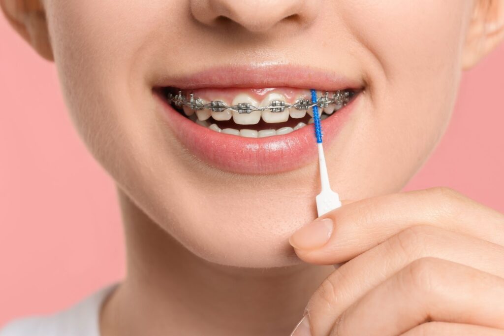 Braces-Friendly Holiday Treats You’ll Actually Love